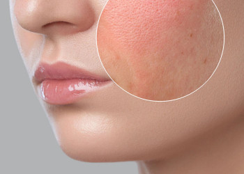 Conquering Dry Skin: A Lady's Guide to Hydration
